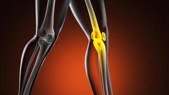 Illustrasjonsfotoet viser et animasjonsbilde av to ben der venstre knee lyser opp gult i kneregionen