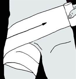 Lyskeskader, forbinding bilde#4