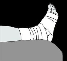 Ankel, trykkbandasje bilde#4