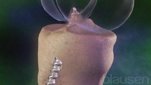 Reparasjon av fremre korsbåndskade