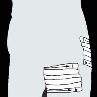 Lyskeskader, forbinding bilde#2