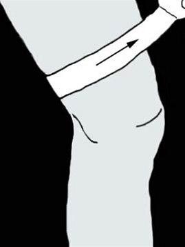 Låret, muskelskader, teiping bilde#1