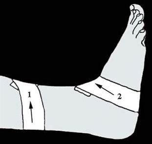 Fot, variasjon av teiping bilde#1