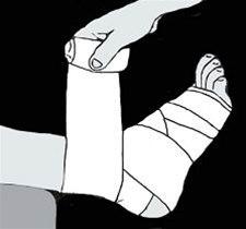 Ankel, trykkbandasje bilde#3