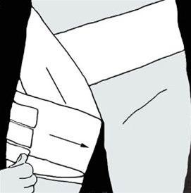 Lyskeskader, forbinding bilde#6