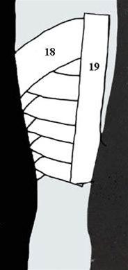 Beinhinnebetennelse, teiping bilde#7